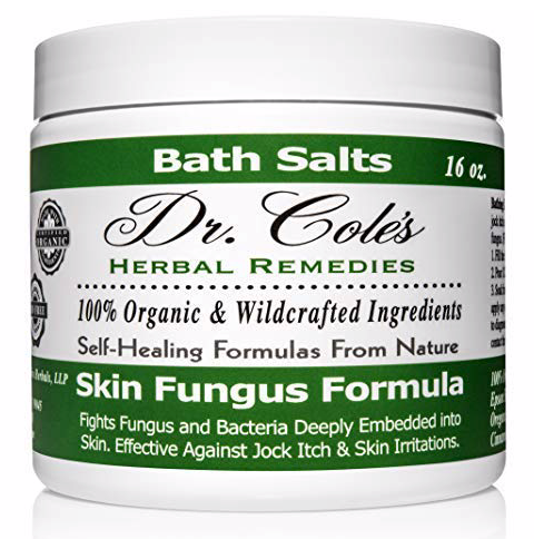 #21 - Anti-Fungal Relief by COLEHERBALS LLC